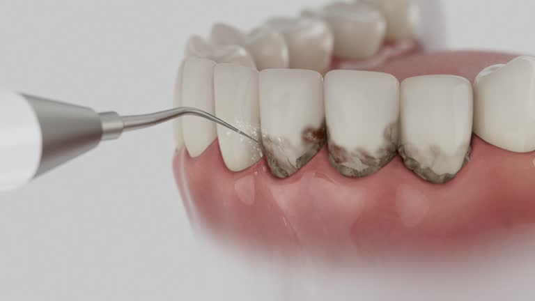 Reliable Dental Implants contractor in Castle Hills, TX by Smile Center Dentistry